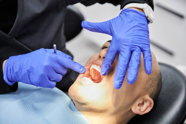 Best Knocked-Out Tooth Emergency  in La Riviera, CA